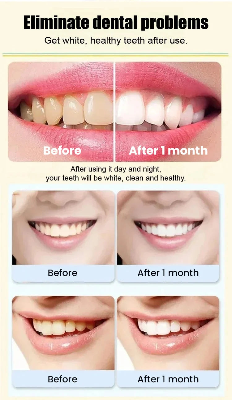 Probiotic Rapid Whitening Toothpaste