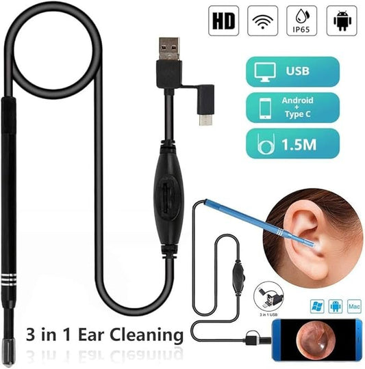 HD Video otoscope【360°Wide Angle & 1296P FHD Video Image