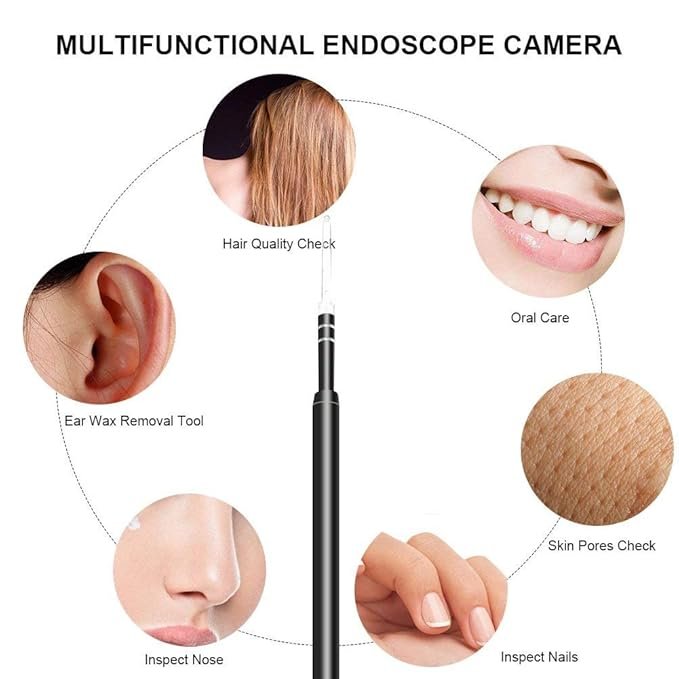 HD Video otoscope【360°Wide Angle & 1296P FHD Video Image